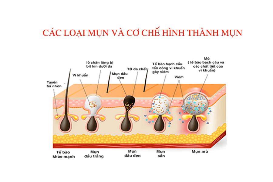 trang trí cây xanh ở cửa sổ